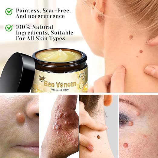 Bee Venom Cream for All Body Parts